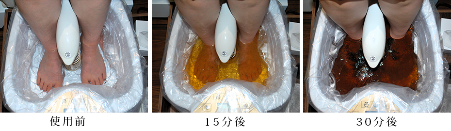 フットデトックス器ゴッドクリーナーゴールド